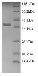 Recombinant Human Cytochrome c (CYCS) – Figure 1 of 1