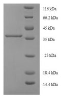 Recombinant Human Cytoglobin (CYGB) – Figure 1 of 1
