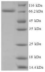 Recombinant Human Cholesterol side-chain cleavage enzyme, mitochondrial (CYP11A1) – Figure 1 of 1