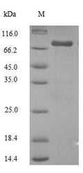 Recombinant Human Steroid 17-alpha-hydroxylase/17,20 lyase (CYP17A1) – Figure 1 of 1