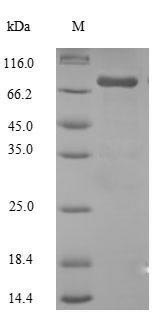 Recombinant Human Steroid 17-alpha-hydroxylase/17,20 lyase (CYP17A1) – Figure 1 of 1
