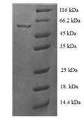 Recombinant Human Steroid 21-hydroxylase (CYP21A2) – Figure 1 of 1