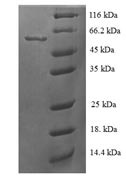 Recombinant Human Steroid 21-hydroxylase (CYP21A2) – Figure 1 of 1