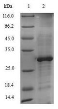(Tris-Glycine gel) Discontinuous SDS-PAGE (reduced) with 5% enrichment gel and 15% separation gel.