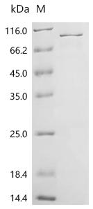 (Tris-Glycine gel) Discontinuous SDS-PAGE (reduced) with 5% enrichment gel and 15% separation gel.
