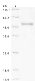 (Tris-Glycine gel) Discontinuous SDS-PAGE (reduced) with 5% enrichment gel and 15% separation gel.