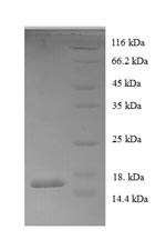 Recombinant Human Acyl-CoA-binding protein (DBI) – Figure 1 of 1