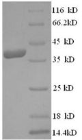 Recombinant Human Dermcidin (DCD) – Figure 1 of 1