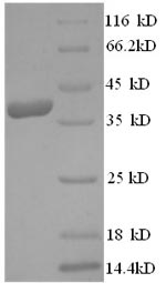 Recombinant Human Dermcidin (DCD) – Figure 1 of 1