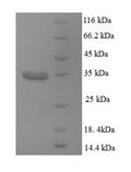 Recombinant Human Dynactin subunit 3 (DCTN3) – Figure 1 of 1