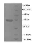 Recombinant Human Dynactin subunit 3 (DCTN3) – Figure 1 of 1