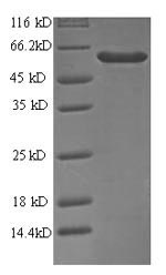 Recombinant Human Antiviral innate immune response receptor RIG-I (RIGI), partial – Figure 1 of 1