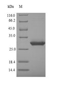 (Tris-Glycine gel) Discontinuous SDS-PAGE (reduced) with 5% enrichment gel and 15% separation gel.
