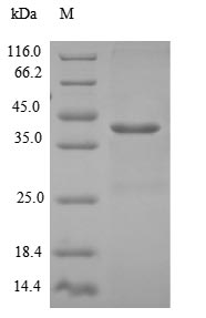 Recombinant Human Density-regulated protein (DENR) – Figure 1 of 1