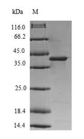 Recombinant Human Diacylglycerol kinase gamma (DGKG), partial – Figure 1 of 1