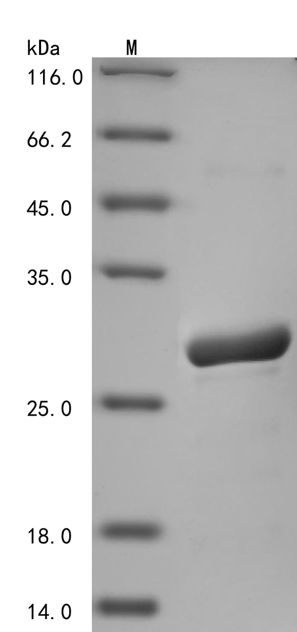 Recombinant Human Dihydrofolate reductase (DHFR) – Figure 1 of 1