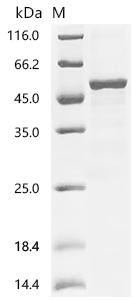 (Tris-Glycine gel) Discontinuous SDS-PAGE (reduced) with 5% enrichment gel and 15% separation gel.