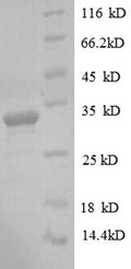 Recombinant Human Protein delta homolog 1 (DLK1), partial – Figure 1 of 1