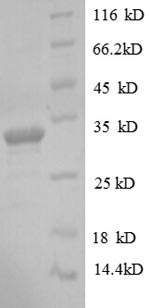 Recombinant Human Protein delta homolog 1 (DLK1), partial – Figure 1 of 1