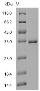 (Tris-Glycine gel) Discontinuous SDS-PAGE (reduced) with 5% enrichment gel and 15% separation gel.