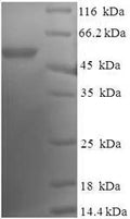 Recombinant Human DnaJ homolog subfamily B member 2 (DNAJB2) – Figure 1 of 1