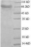 Recombinant Human Aspartyl aminopeptidase (DNPEP), partial – Figure 1 of 1