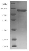 Recombinant Human DNA nucleotidylexotransferase (DNTT) – Figure 1 of 1