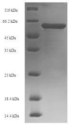 Recombinant Human DNA nucleotidylexotransferase (DNTT) – Figure 1 of 1