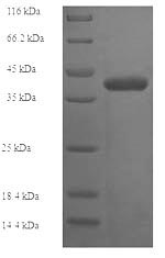 Recombinant Human Deoxynucleotidyltransferase terminal-interacting protein 1 (DNTTIP1) – Figure 1 of 1