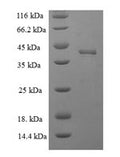 Recombinant Human Docking protein 5 (DOK5), partial – Figure 1 of 1