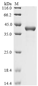 (Tris-Glycine gel) Discontinuous SDS-PAGE (reduced) with 5% enrichment gel and 15% separation gel.