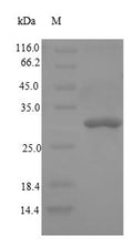 (Tris-Glycine gel) Discontinuous SDS-PAGE (reduced) with 5% enrichment gel and 15% separation gel.