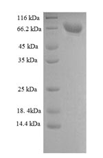 Recombinant Rat Dipeptidyl aminopeptidase-like protein 6 (Dpp6), partial – Figure 1 of 1