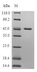 (Tris-Glycine gel) Discontinuous SDS-PAGE (reduced) with 5% enrichment gel and 15% separation gel.