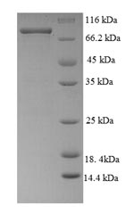 Recombinant Human Desmoglein-3 (DSG3), partial – Figure 1 of 1