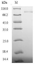 Recombinant Human Desmoglein-3 (DSG3), partial – Figure 1 of 1