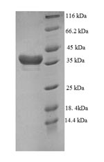 Recombinant Human DTW domain-containing protein 1 (DTWD1), partial – Figure 1 of 1