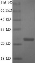 Recombinant Bacillus anthracis Thymidylate kinase (tmk) – Figure 1 of 1