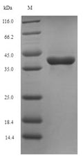 (Tris-Glycine gel) Discontinuous SDS-PAGE (reduced) with 5% enrichment gel and 15% separation gel.