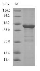 Recombinant Human Dual specificity protein phosphatase 14 (DUSP14) – Figure 1 of 1