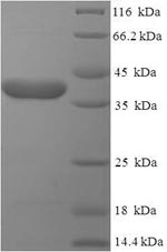 Recombinant Human Receptor-binding cancer antigen expressed on SiSo cells (EBAG9), partial – Figure 1 of 1
