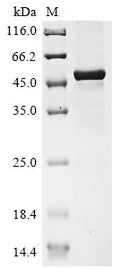 Recombinant Human Interleukin-27 subunit beta (EBI3), partial – Figure 1 of 1