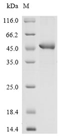 (Tris-Glycine gel) Discontinuous SDS-PAGE (reduced) with 5% enrichment gel and 15% separation gel.