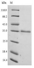 Recombinant Human Elongation factor 1-delta (EEF1D) – Figure 1 of 1