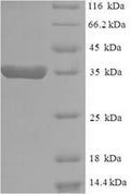 Recombinant Human Eukaryotic translation elongation factor 1 epsilon-1 (EEF1E1) – Figure 1 of 1