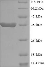 Recombinant Human Eukaryotic translation elongation factor 1 epsilon-1 (EEF1E1) – Figure 1 of 1