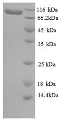 Recombinant Human Elongation factor 2 (EEF2) – Figure 1 of 1