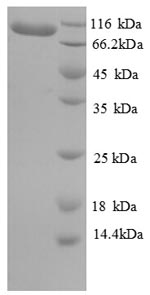 Recombinant Human Elongation factor 2 (EEF2) – Figure 1 of 1