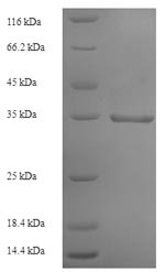 Recombinant Human Ephrin-A1 (EFNA1) – Figure 1 of 1