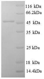 (Tris-Glycine gel) Discontinuous SDS-PAGE (reduced) with 5% enrichment gel and 15% separation gel.